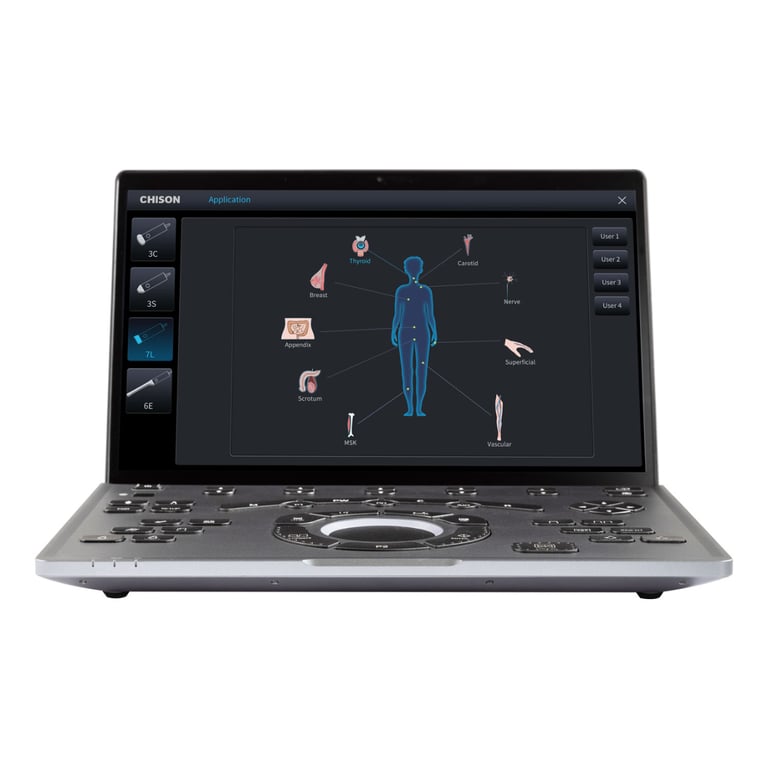 Chison SonoAir 70 Laptop-Ultraschall