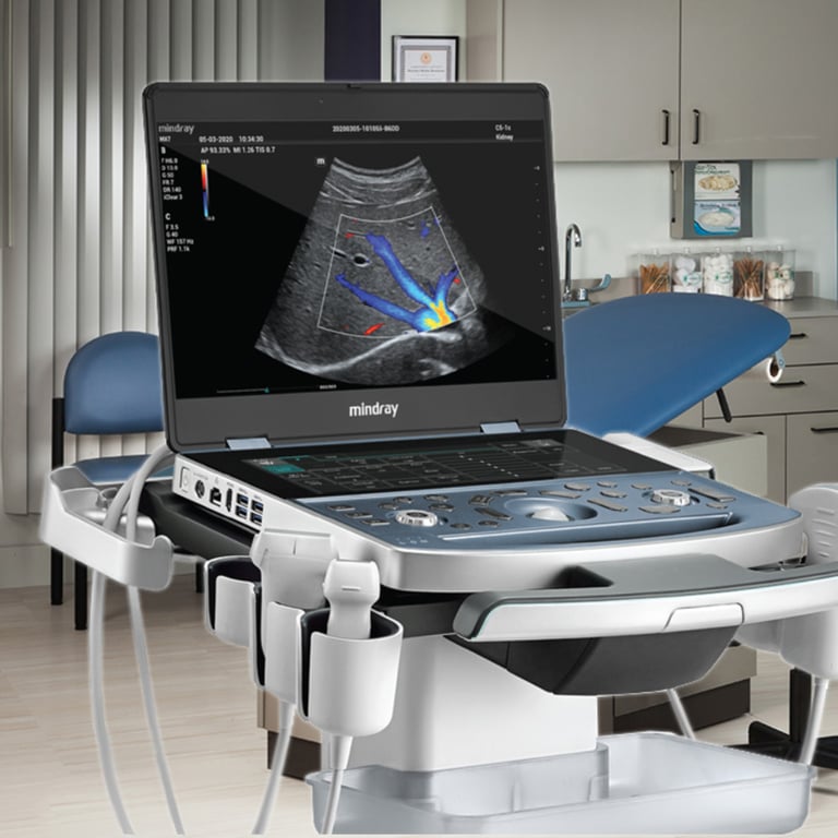 Mindray MX7 Laptop-Ultraschall mit 15,6-Zoll-Display und 12,3-Zoll-Touchscreen