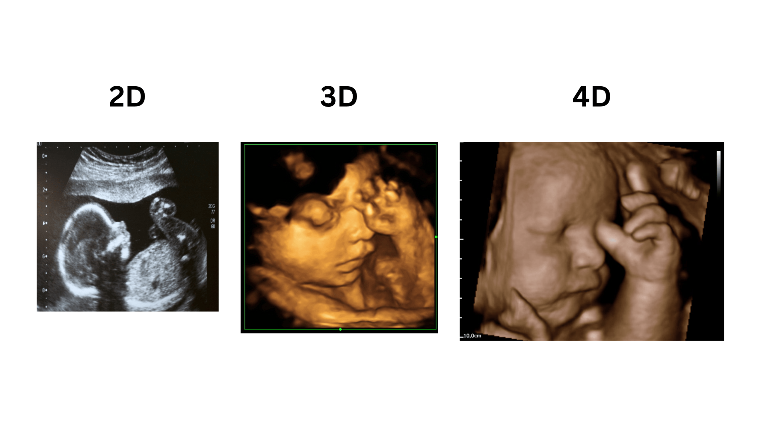 Image Widget